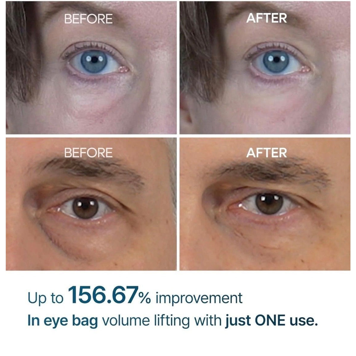 Dr. Melaxin Eyephalt Eye Cream